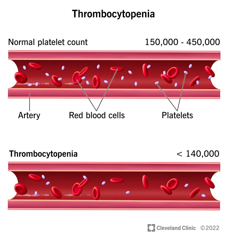 platelets